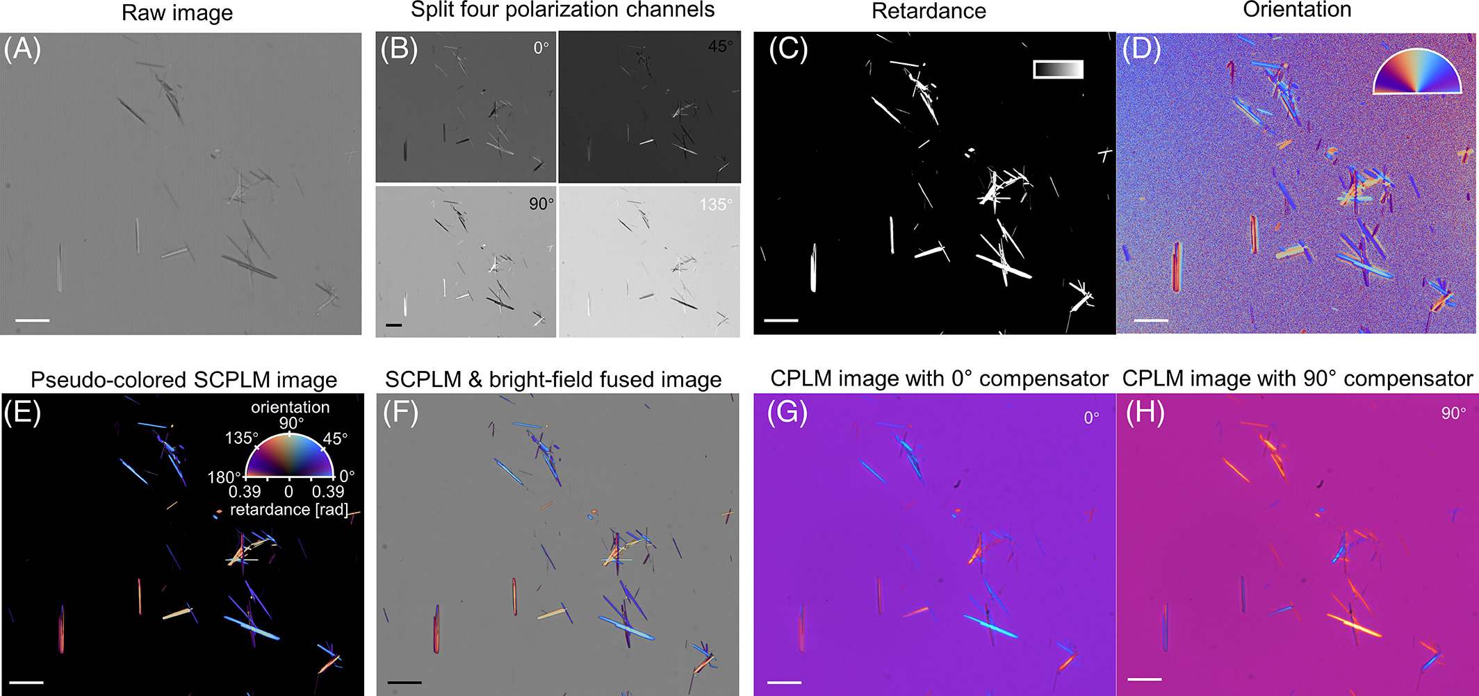 Pathological Crystal Imaging Using Computational Polarized Light Microscopy.