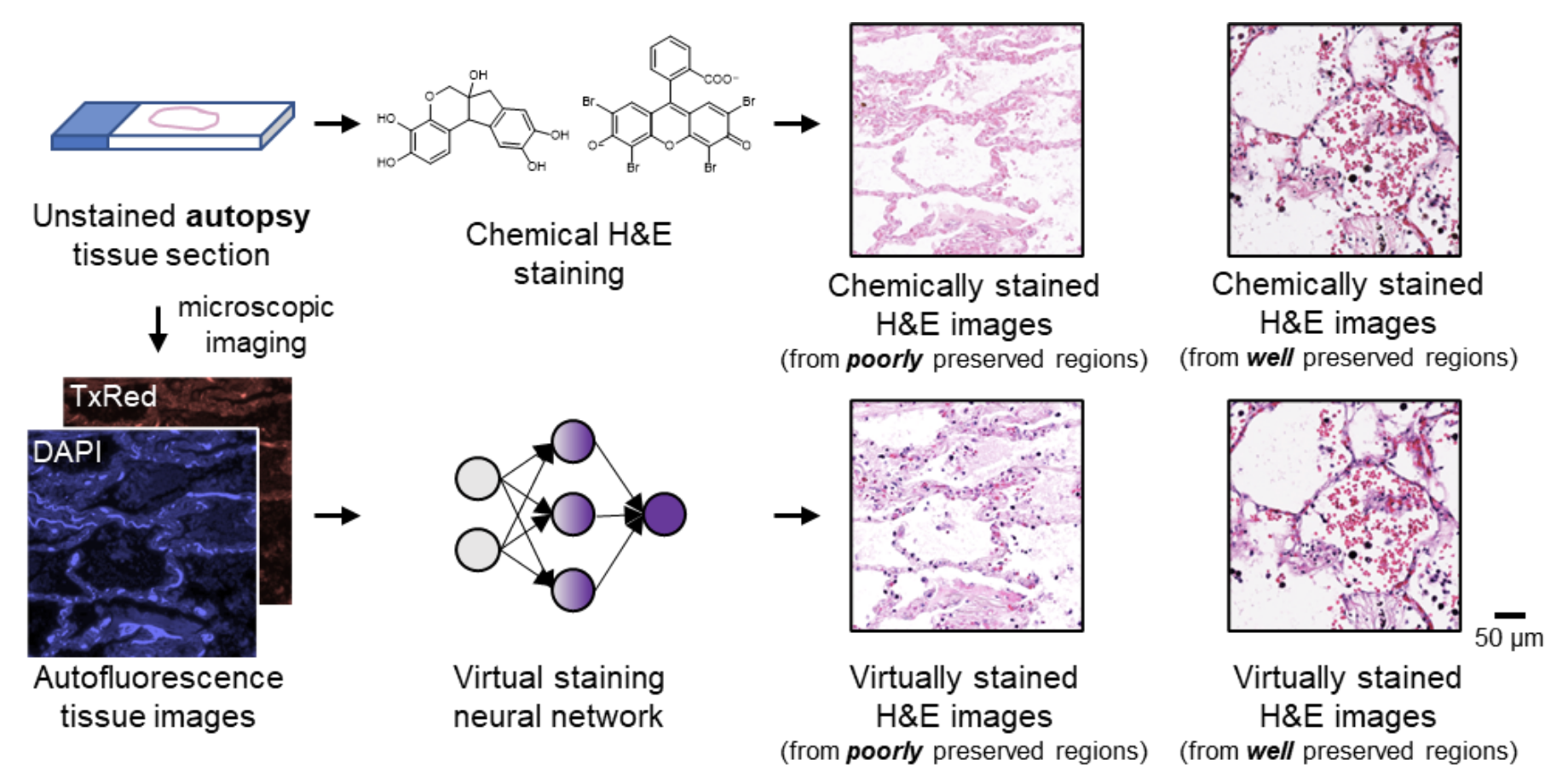 Virtual staining of label-free autopsy tissue sections via deep learning